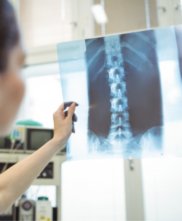 radiographie