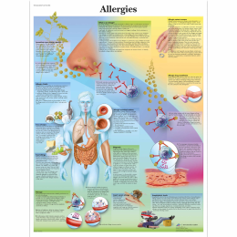 Les allergies